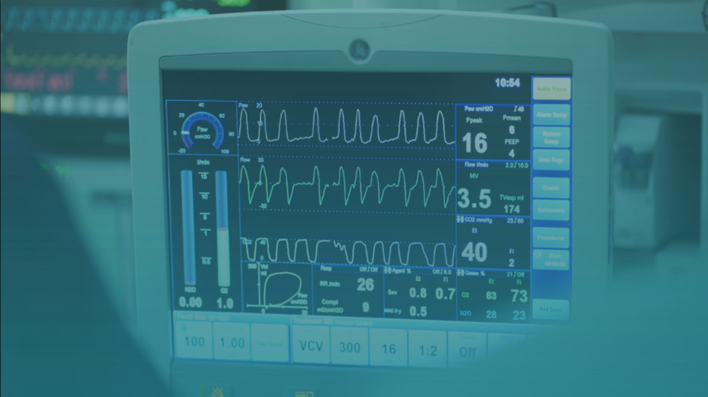 Video thumbnail for: Can I file a personal injury claim?